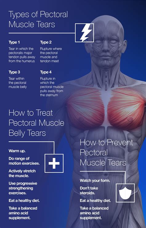 pectoralis minor tear test|pec minor tear recovery time.